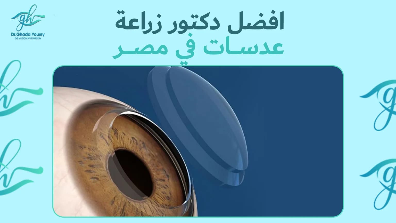 افضل دكتور زراعة عدسات في مصر| دكتورة غادة يسري