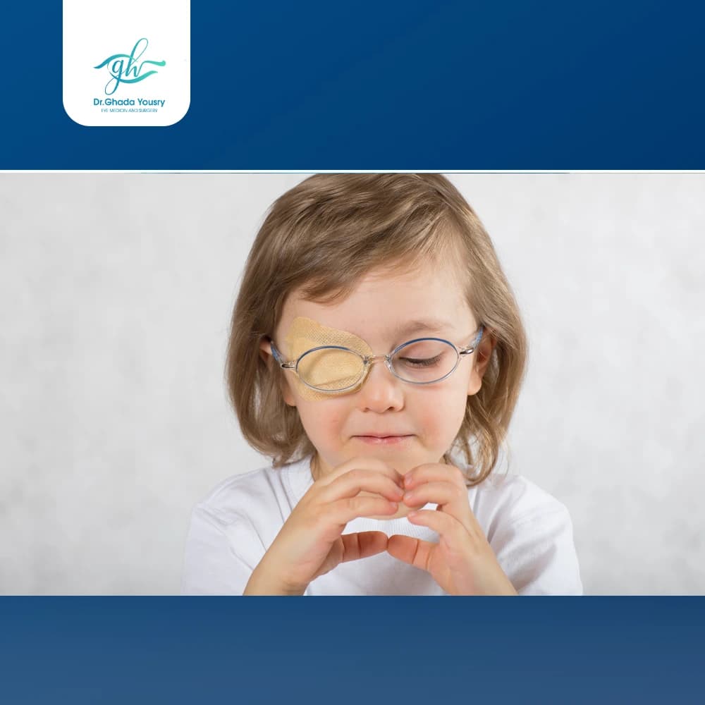 Amblyopia (lazy eye)