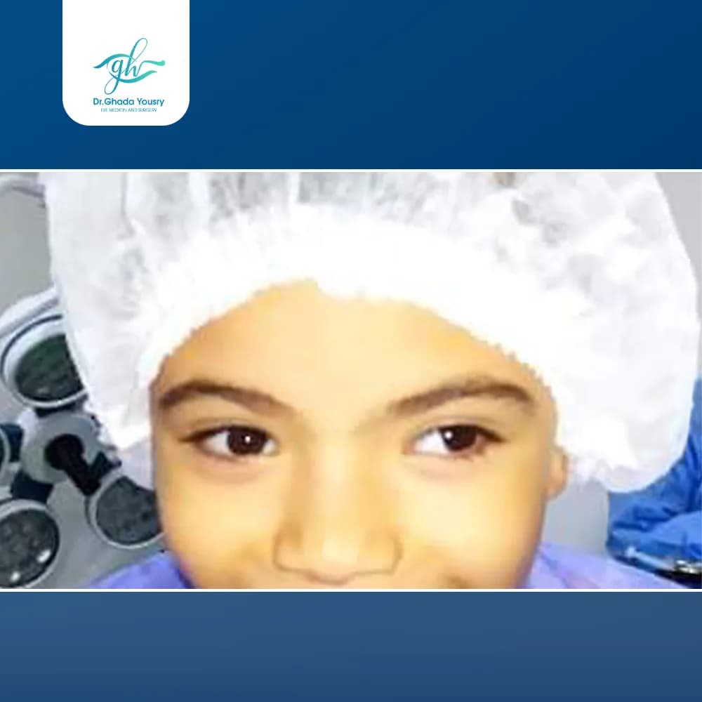 Exotropia in children