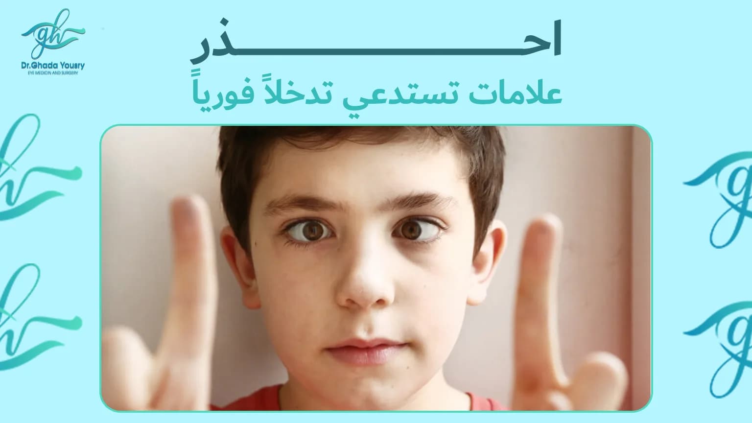 متى يكون الحول خطيرًا ويحتاج تدخلًا فوريًا؟