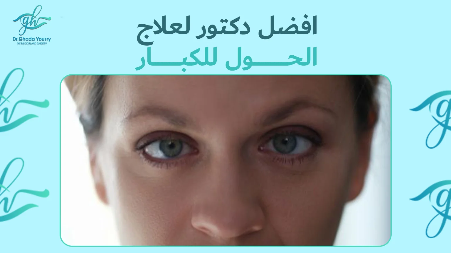 أفضل دكتور لعلاج الحول للكبار