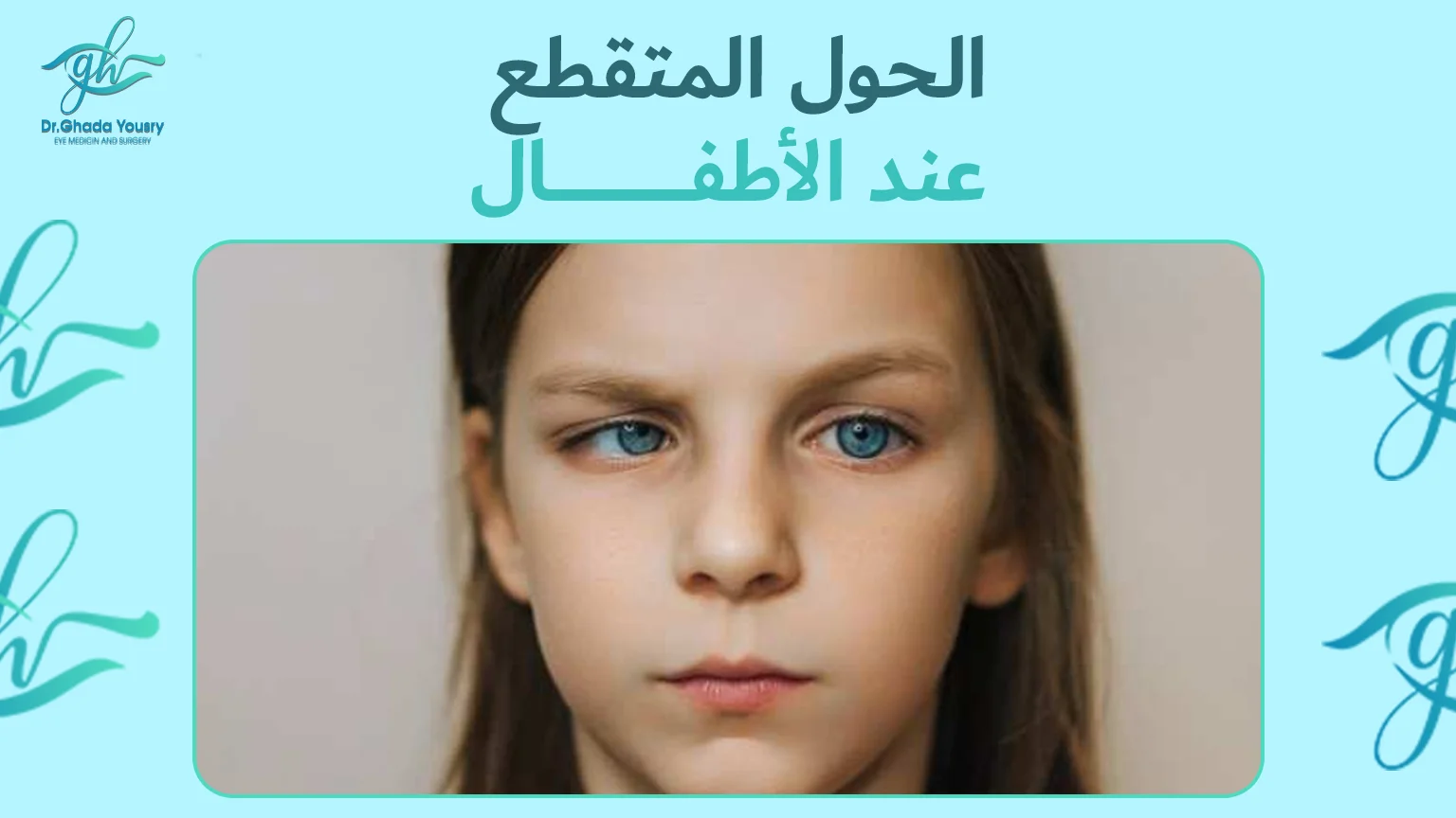 الحول المتقطع عند الأطفال وأفضل طرق تصحيحه