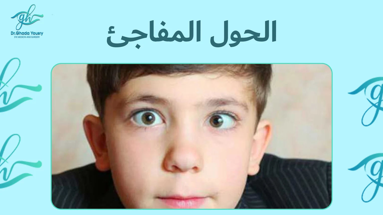 الحول المفاجئ عند الأطفال | الأسباب، والعلاج مع د. غادة يسري