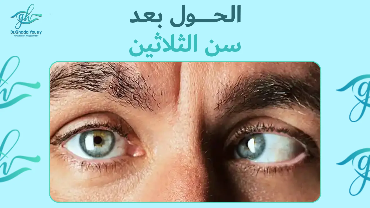 أزمة الحول بعد سن الثلاثين : وهل يمكن علاجها؟
