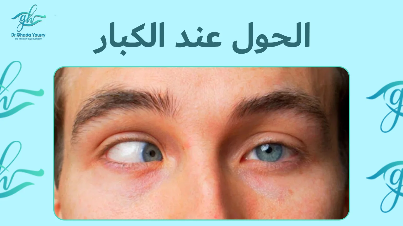 علاج الحول عند الكبار جراحياً وغير جراحياً مع دكتورة غادة