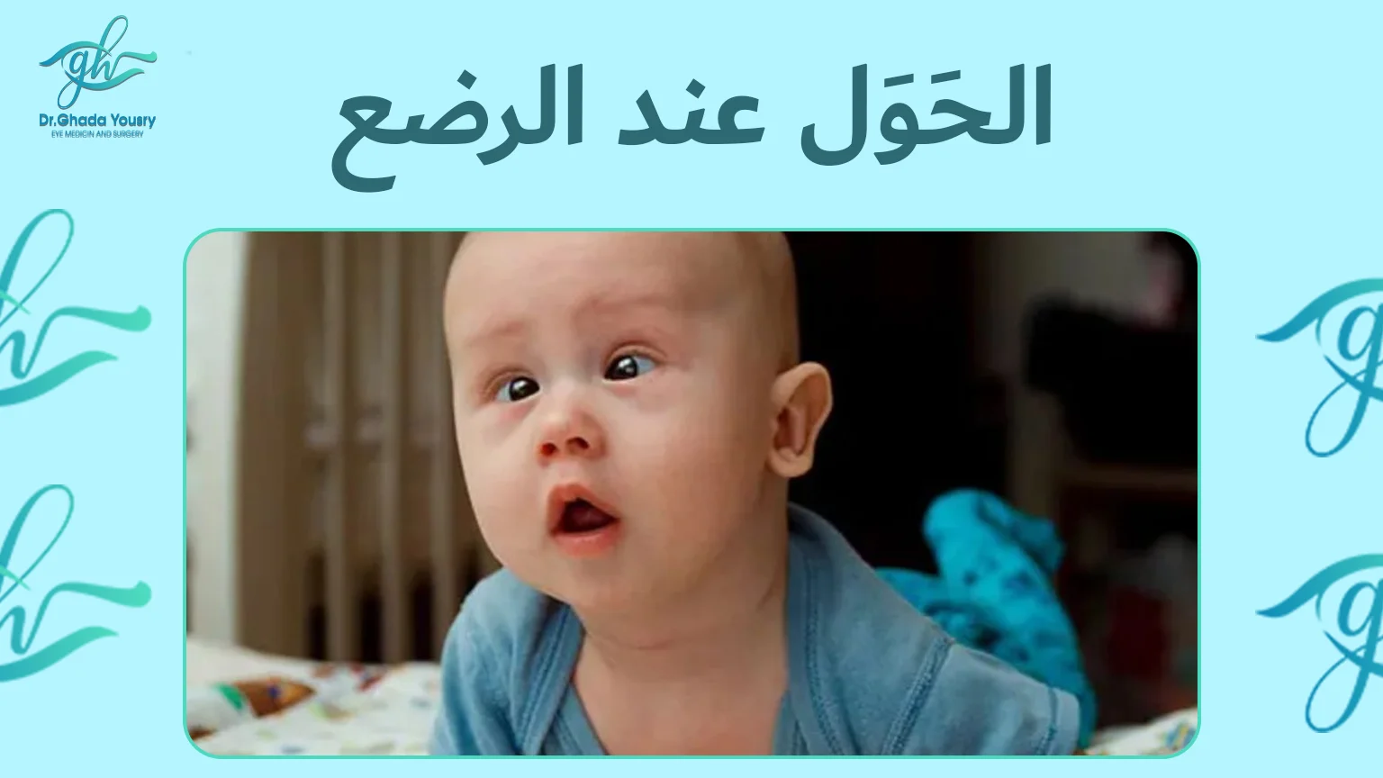 الحَوَل عند الرضع