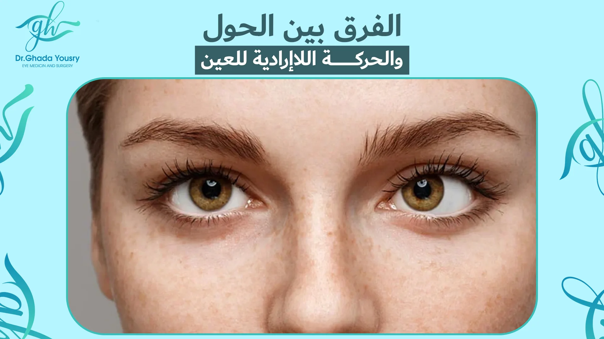 الفرق بين الحول والحركة اللاإرادية للعين