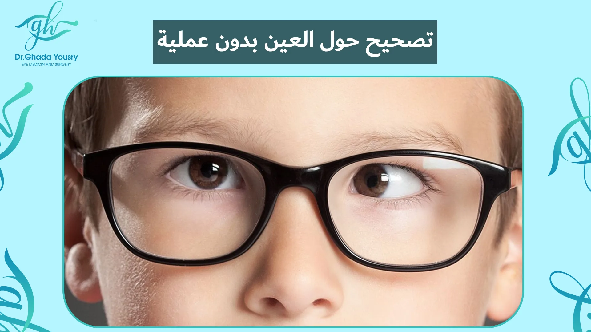 تصحيح حول العين بدون عملية | طرق علاج الحول بدون جراحة مع د. غادة يسري