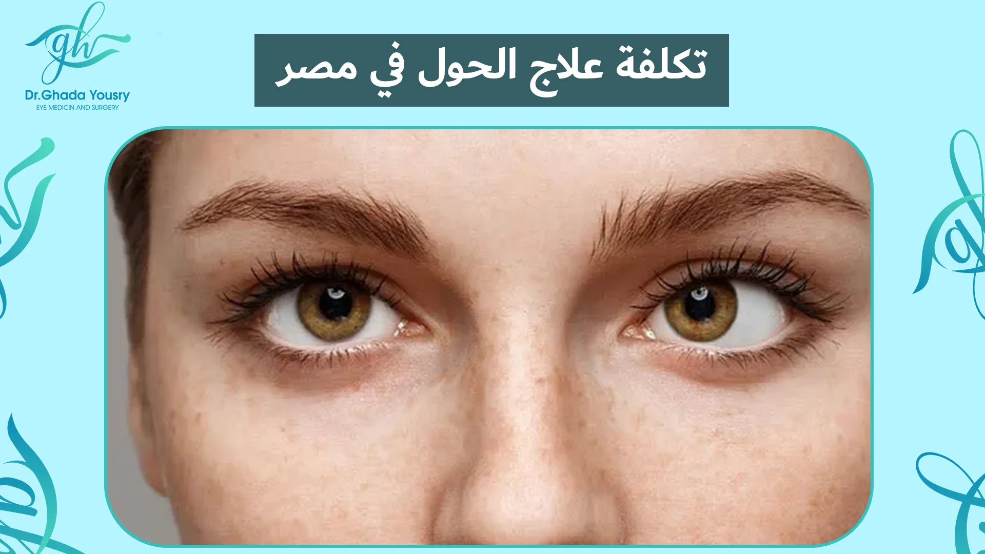 تكلفة علاج الحول في مصر 2025 | أفضل دكتور لعلاج الحول