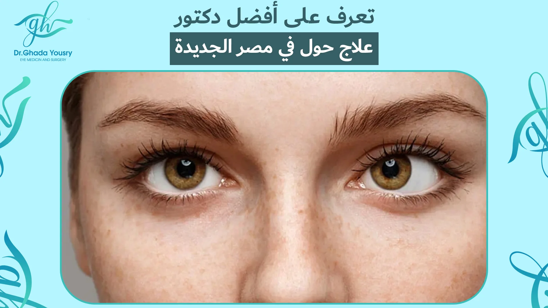 تعرف على أفضل دكتور علاج حول في مصر الجديدة