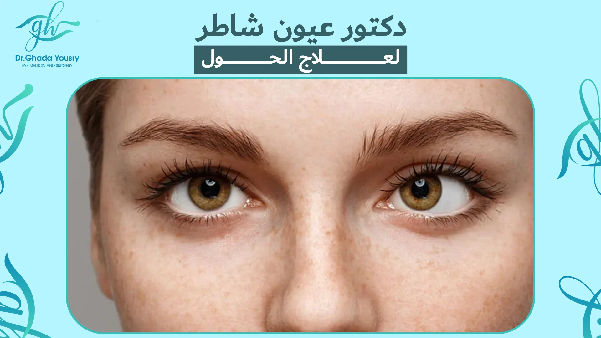 دكتور عيون شاطر لعلاج الحول | د. غادة يسري أفضل طبيبة