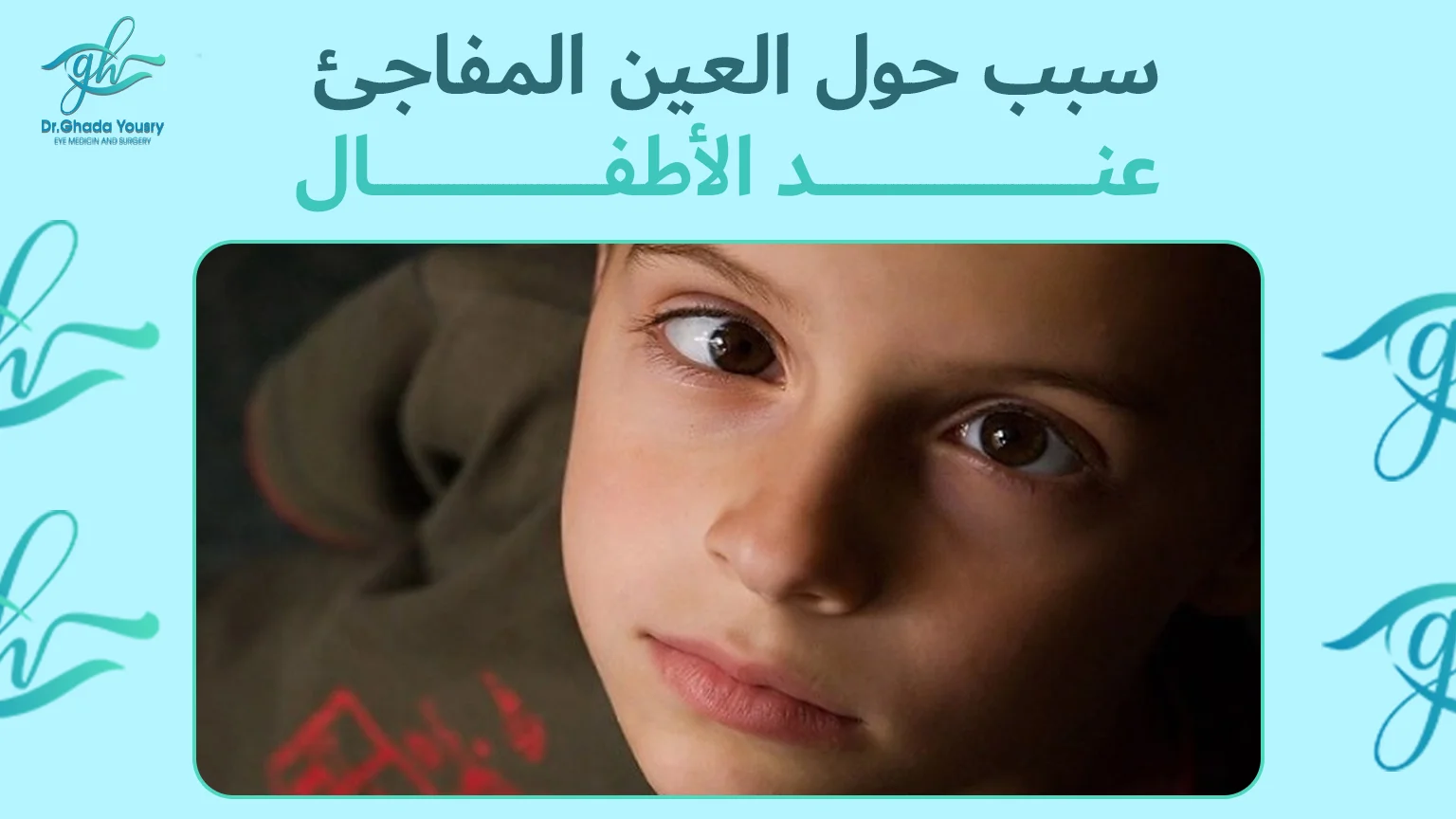 سبب حول العين المفاجئ عند الأطفال | تعرف على أهم 7 أسباب