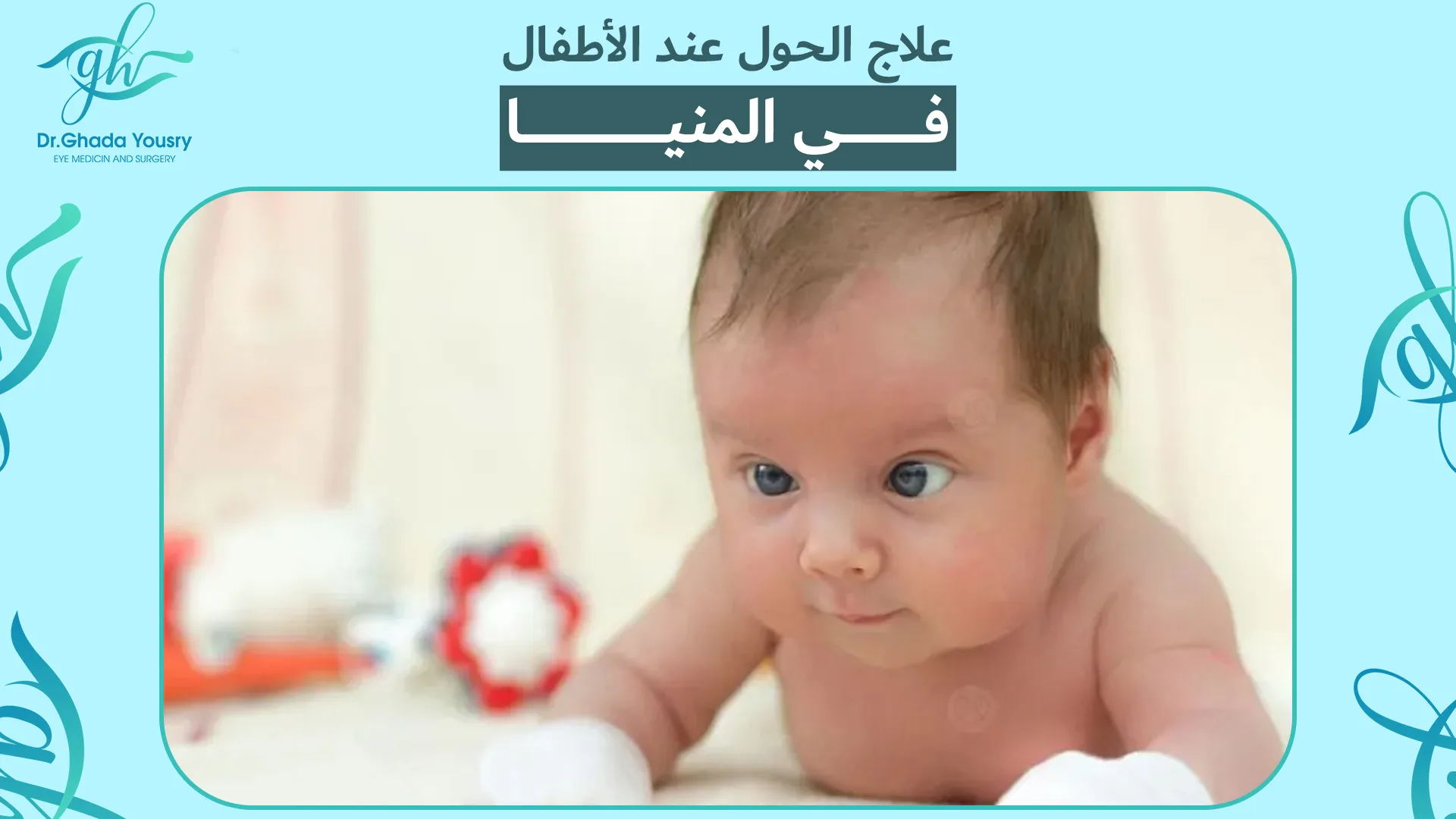 علاج الحول عند الأطفال في المنيا | خبرة وتميّز مع د. غادة