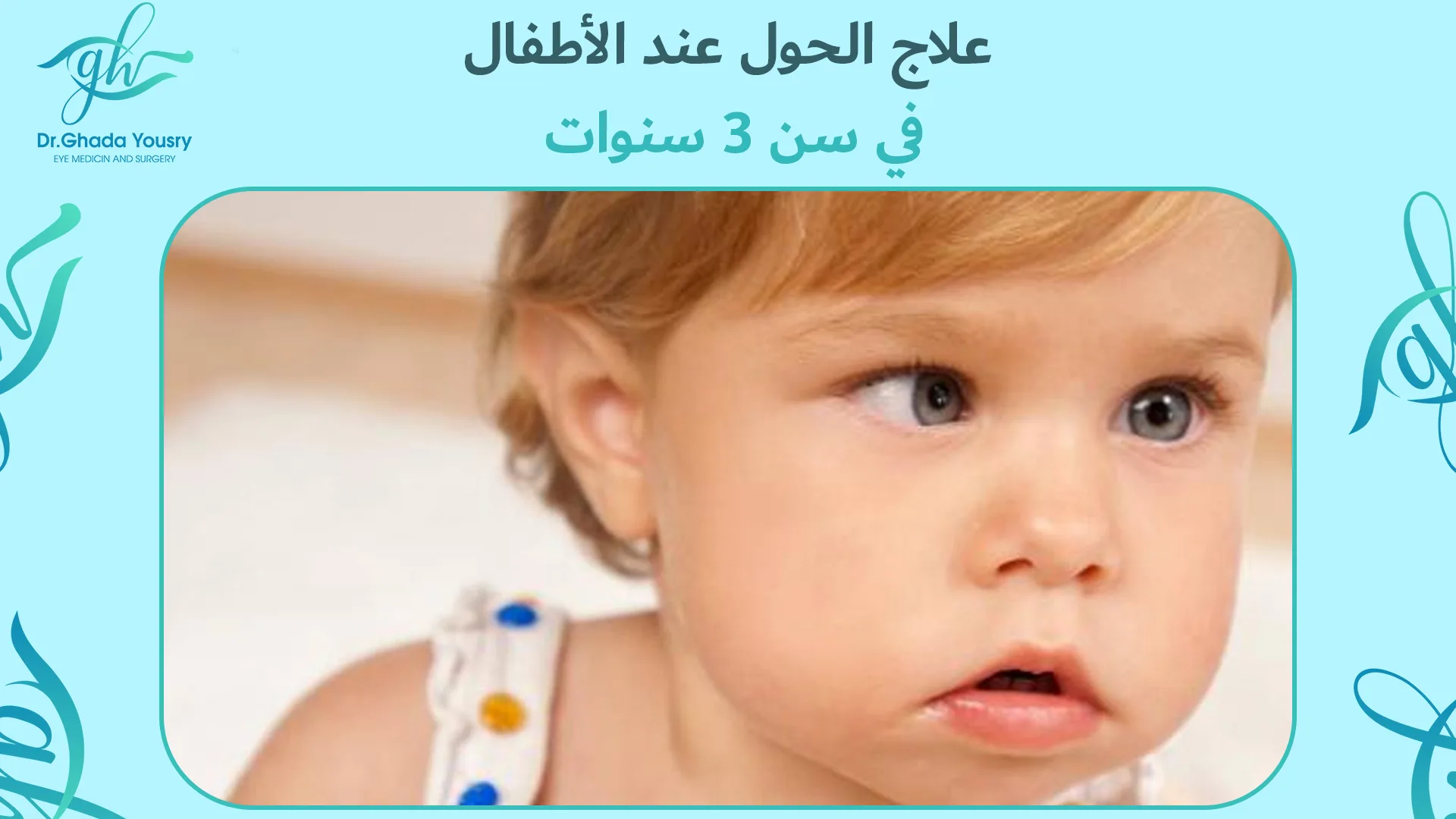 علاج الحول عند الأطفال في سن 3 سنوات