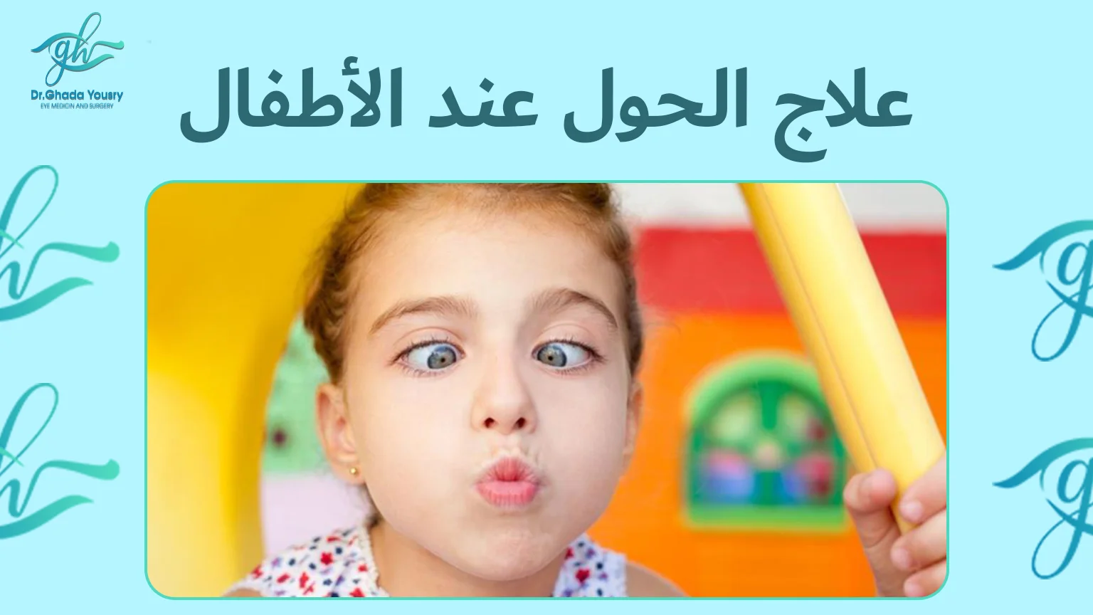علاج الحول عند الاطفال مع دكتورة غادة يسري