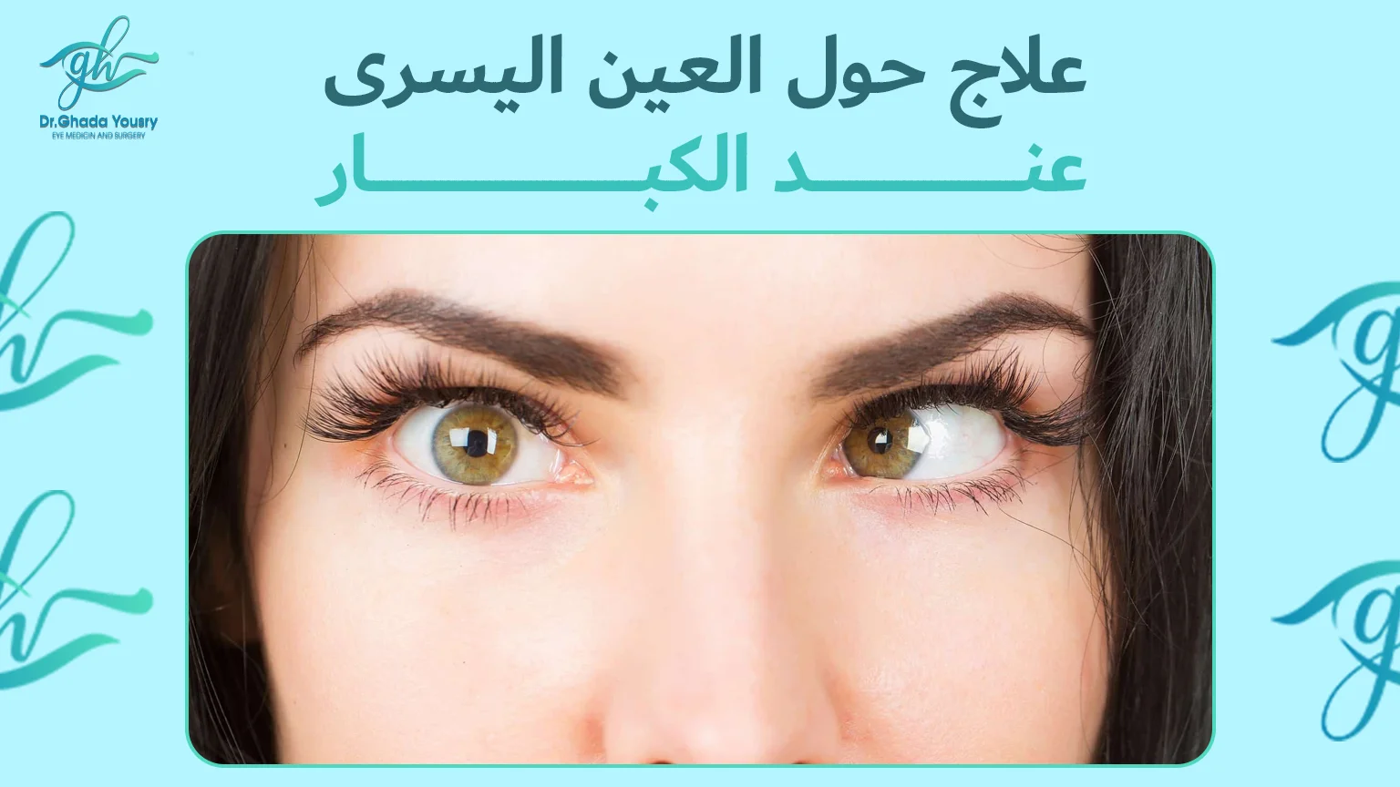 علاج حول العين اليسرى عند الكبار