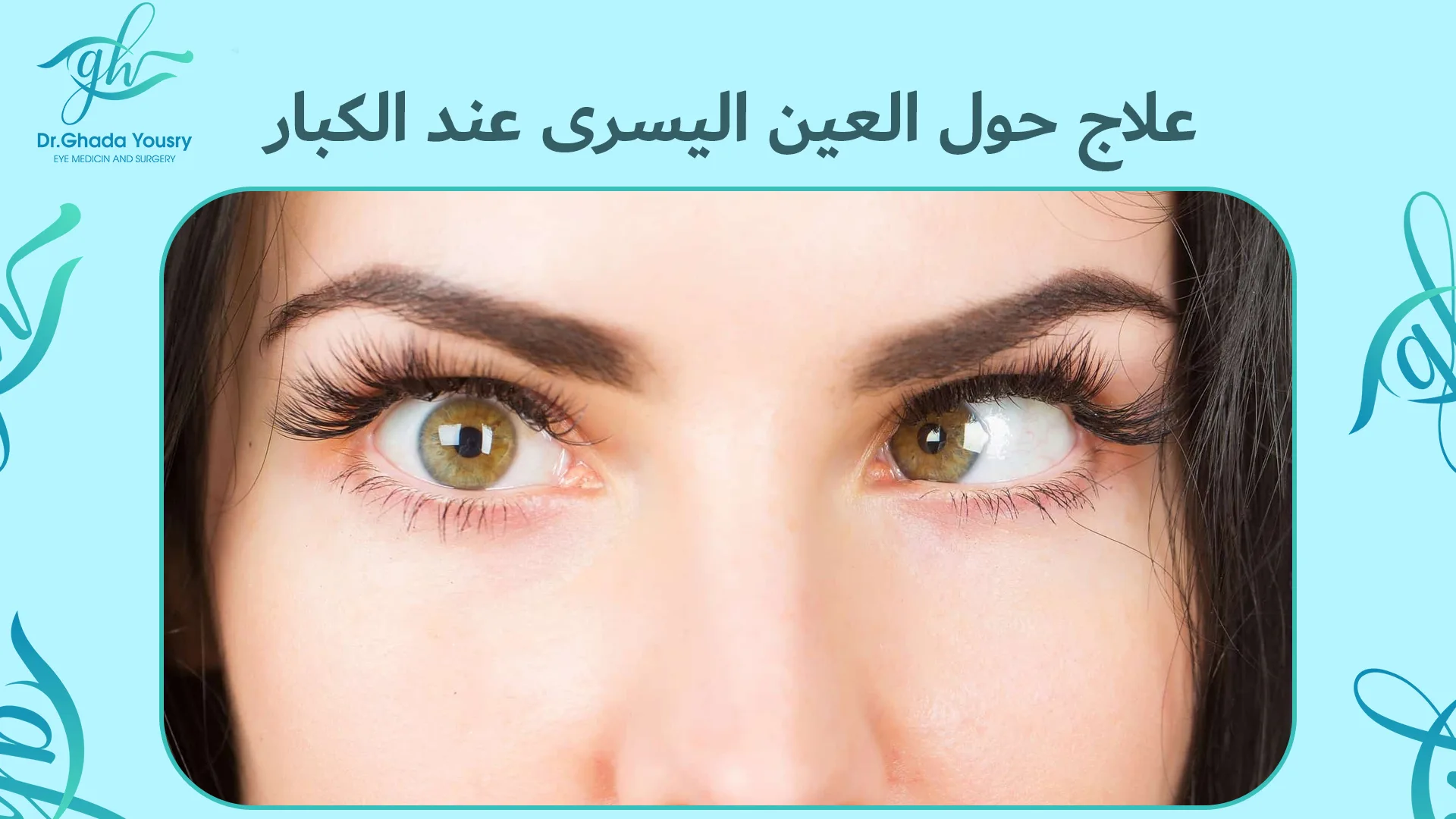 علاج حول العين اليسرى عند الكبار مع دكتورة غادة يسري