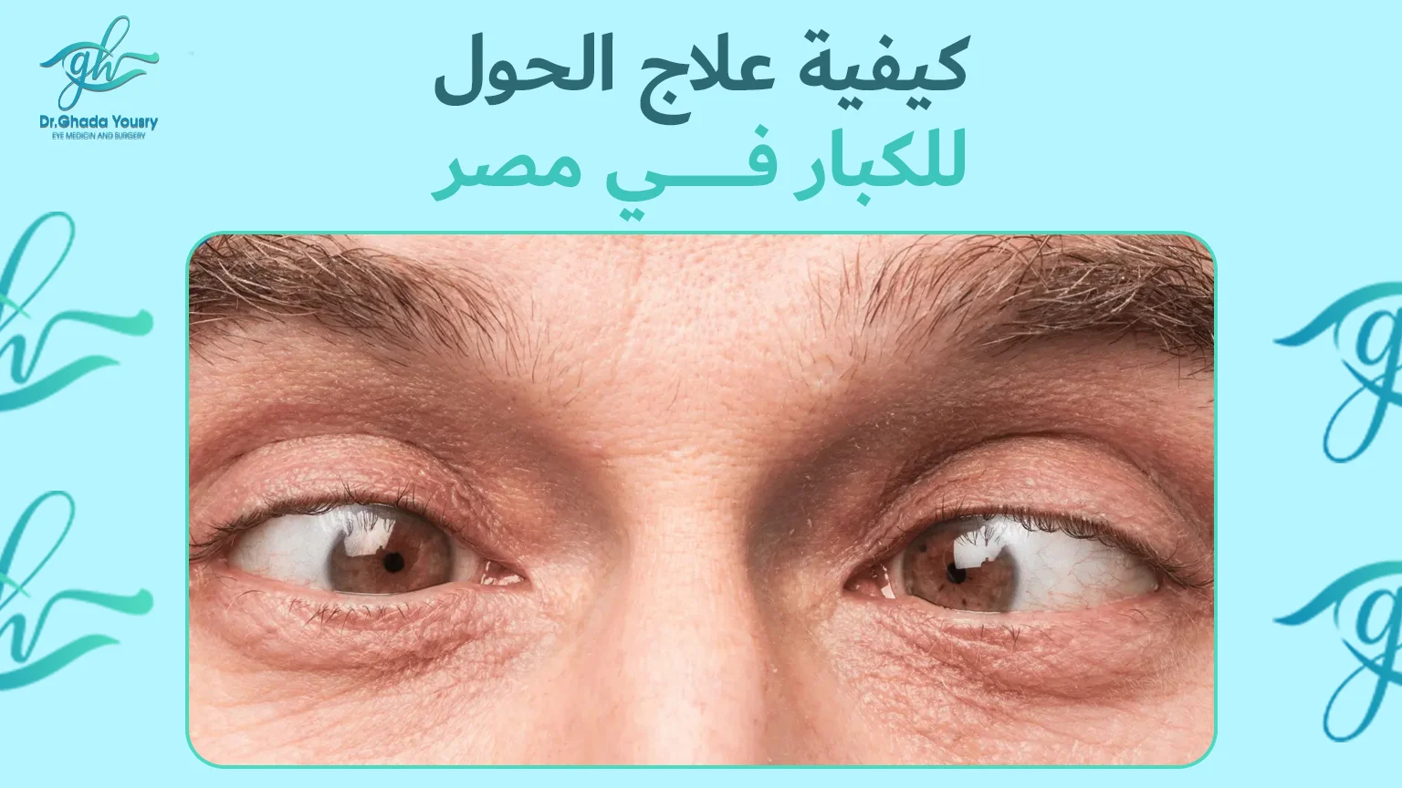 علاج الحول عند الأطفال في مصر | د. غادة يسري أفضل دكتورة عيون أطفال