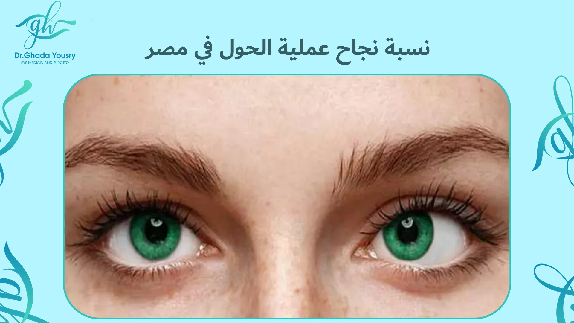 نسبة نجاح عملية الحول في مصر
