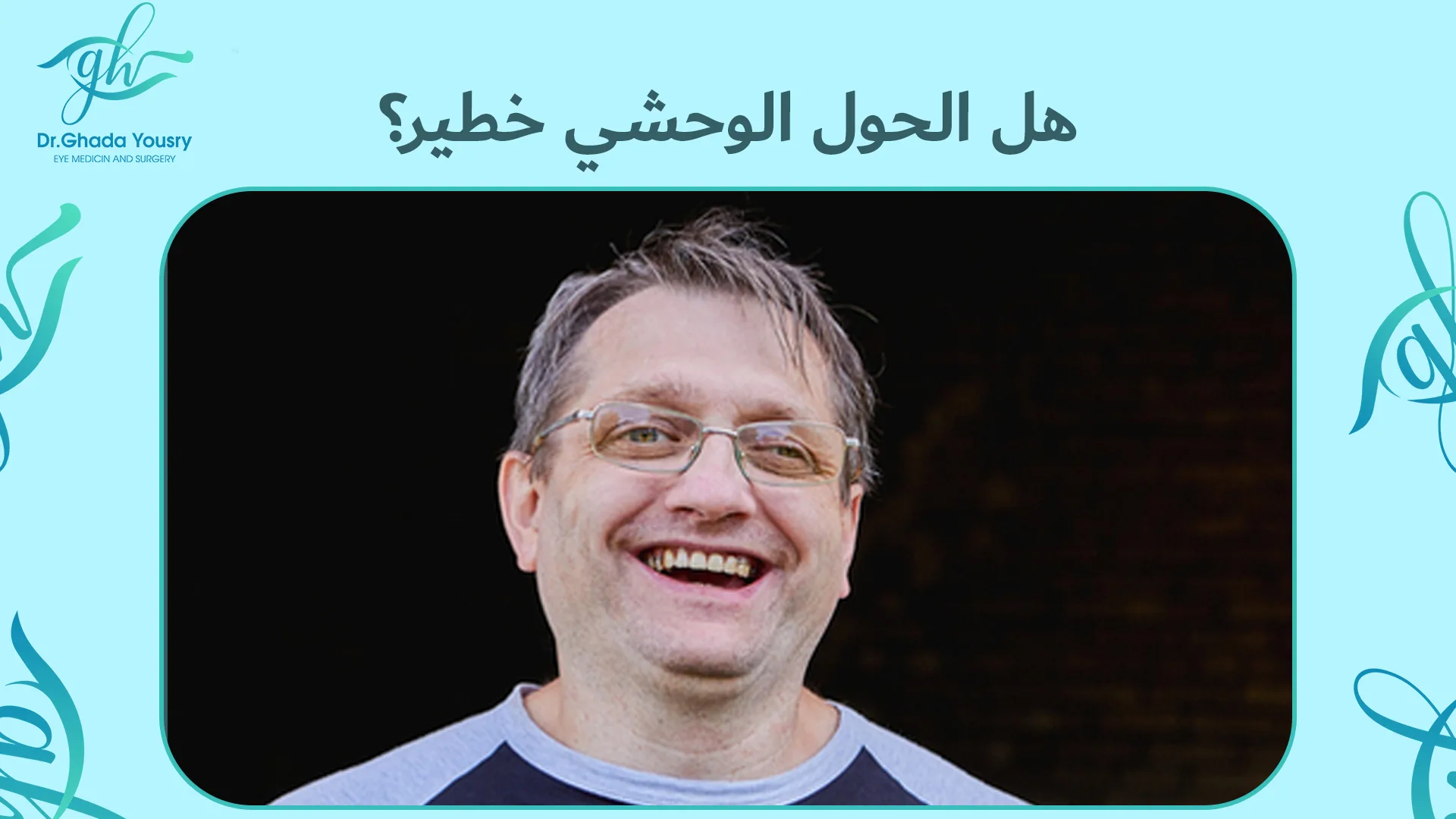هل الحول الوحشي خطير؟ الأسباب والأعراض وطرق العلاج بالتفصيل