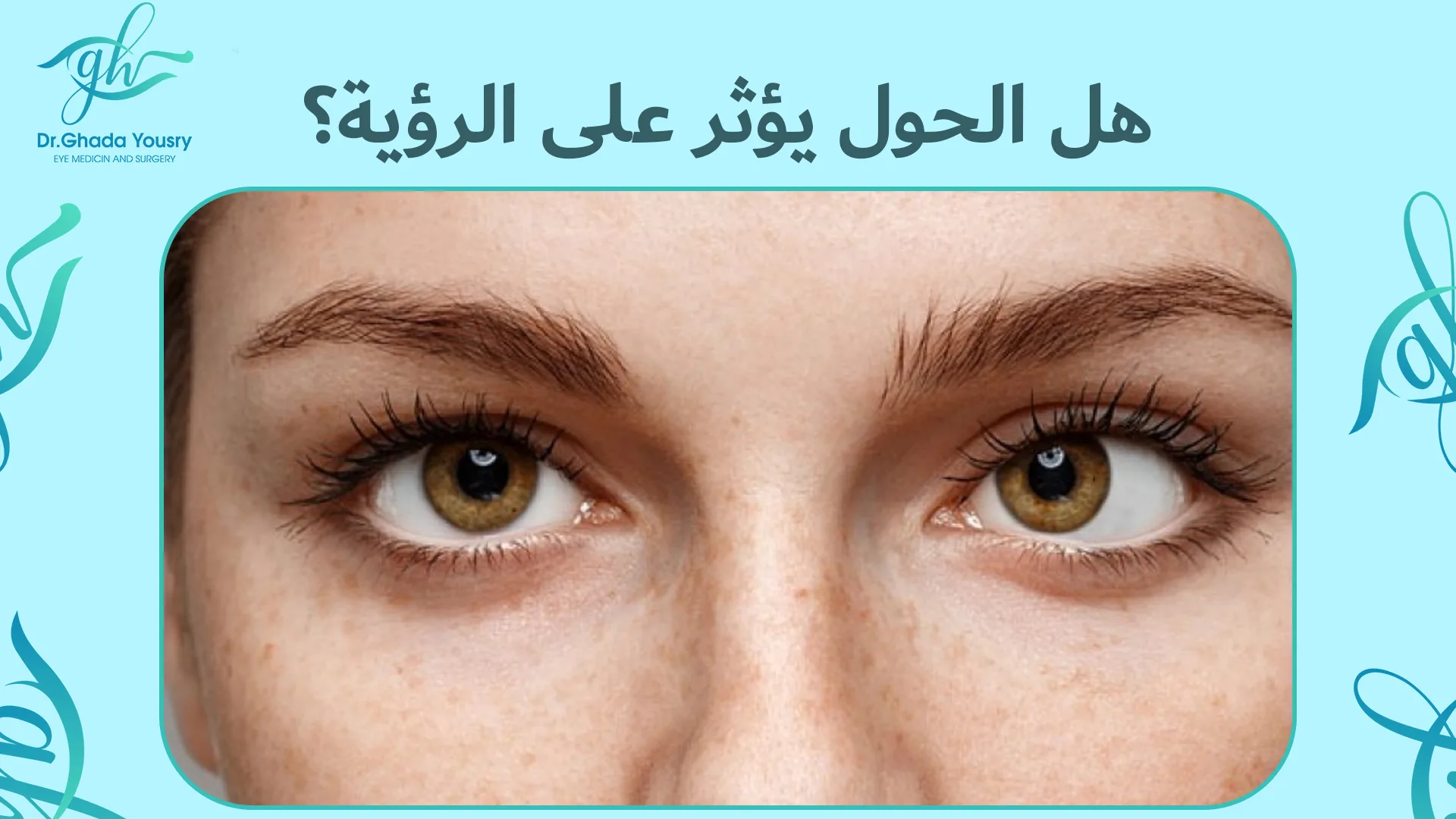 هل الحول يؤثر على الرؤية؟