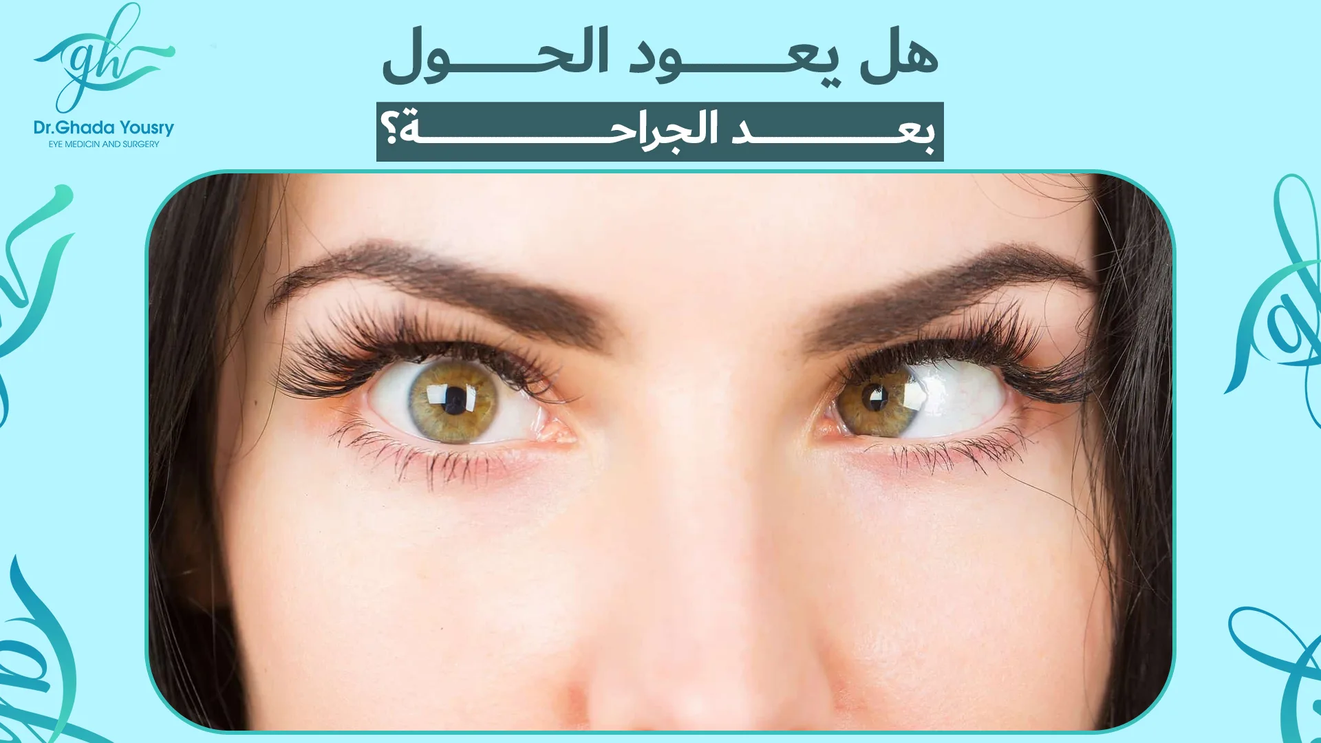 هل يعود الحول بعد العملية؟ | الأسباب ونصائح لمنع تكرار الحول