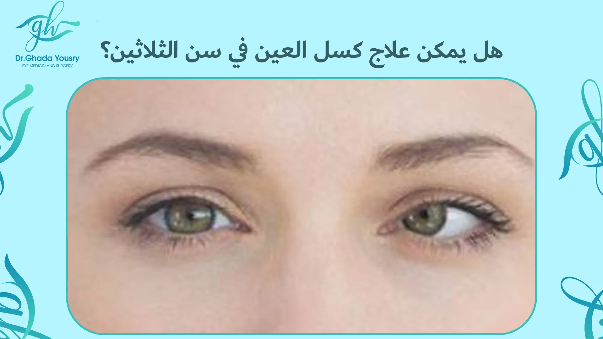 هل يمكن علاج كسل العين في سن الثلاثين؟