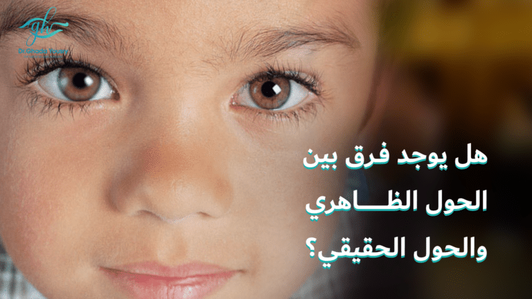 Read more about the article هل يوجد فرق بين الحول الظاهري والحَوَل الحقيقي؟