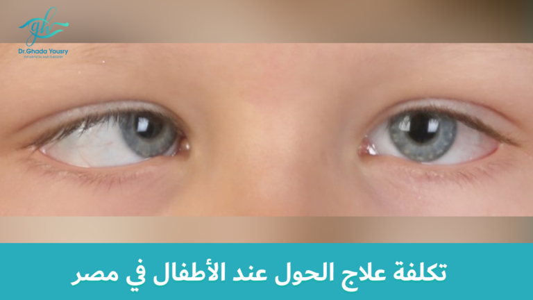 Read more about the article تكلفة علاج الحول عند الأطفال في مصر: العوامل المؤثرة والتفاصيل الكاملة
