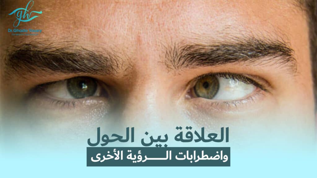 العلاقة بين الحول واضطرابات الرؤية الأخرى