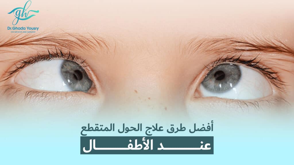 أفضل طرق علاج الحول المتقطع عند الأطفال