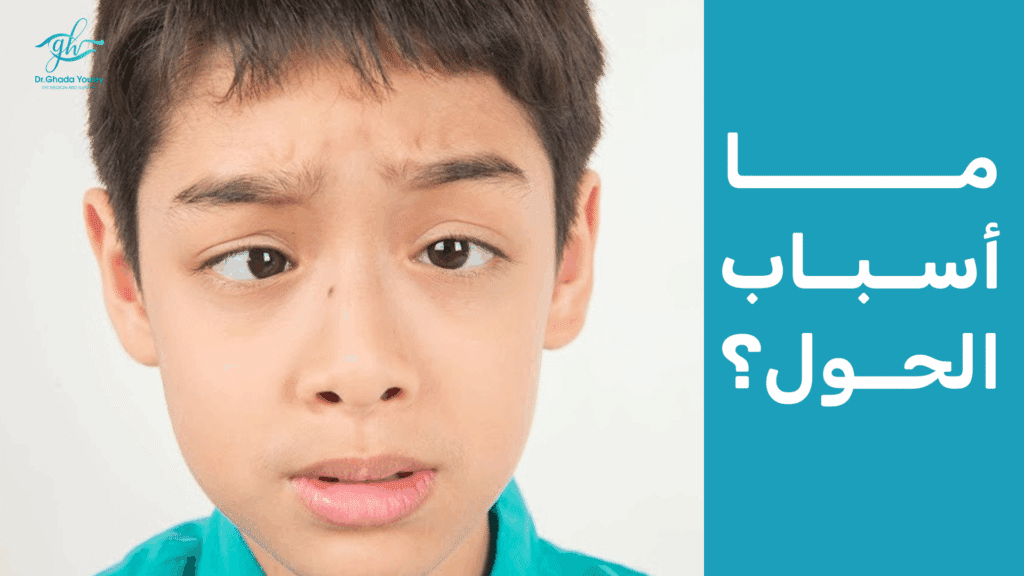 ما أسباب الحول