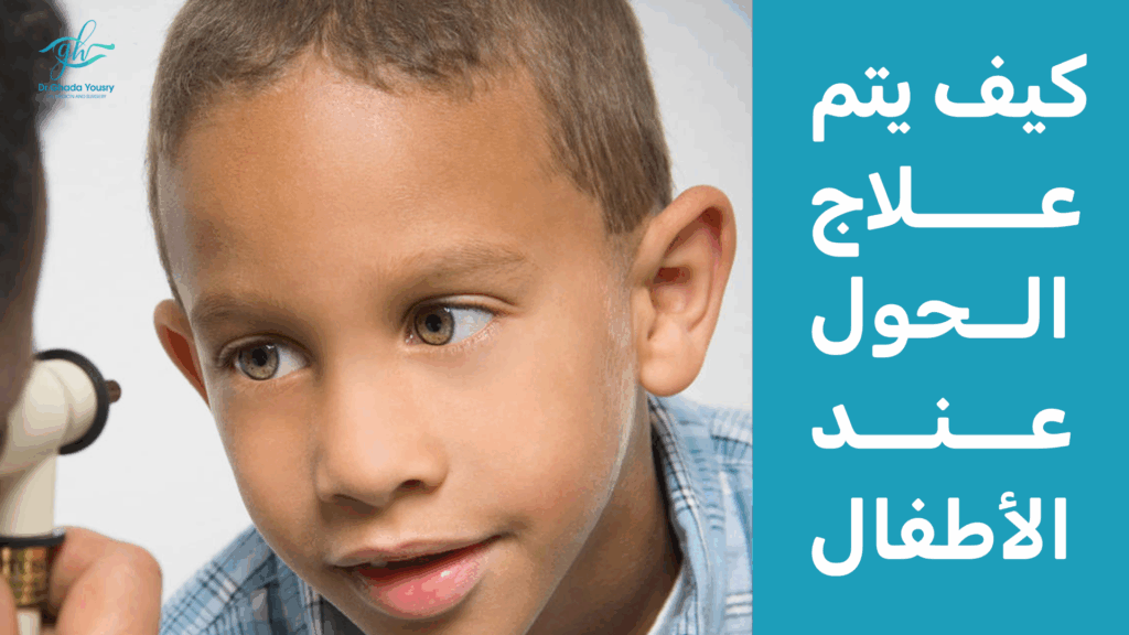 كيف يتم علاج الحول عند الأطفال