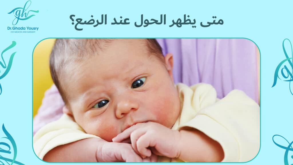 متى يظهر الحول عند الرضع؟